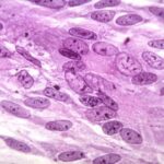 Histological slide showing cell structures